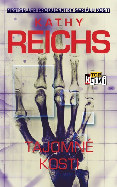 Tajomné kosti - Kathy Reichs